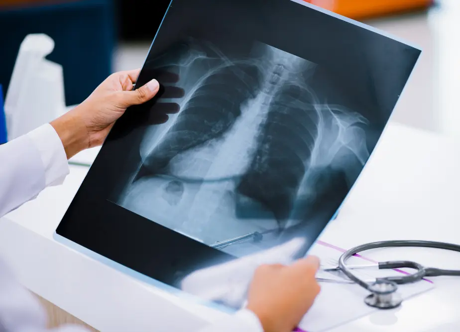 Sobre para radiografía Imadine
