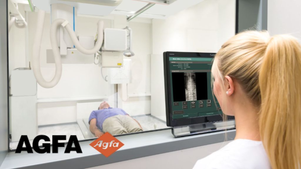 DR 600 Agfa – Sala de Radiografía Digital